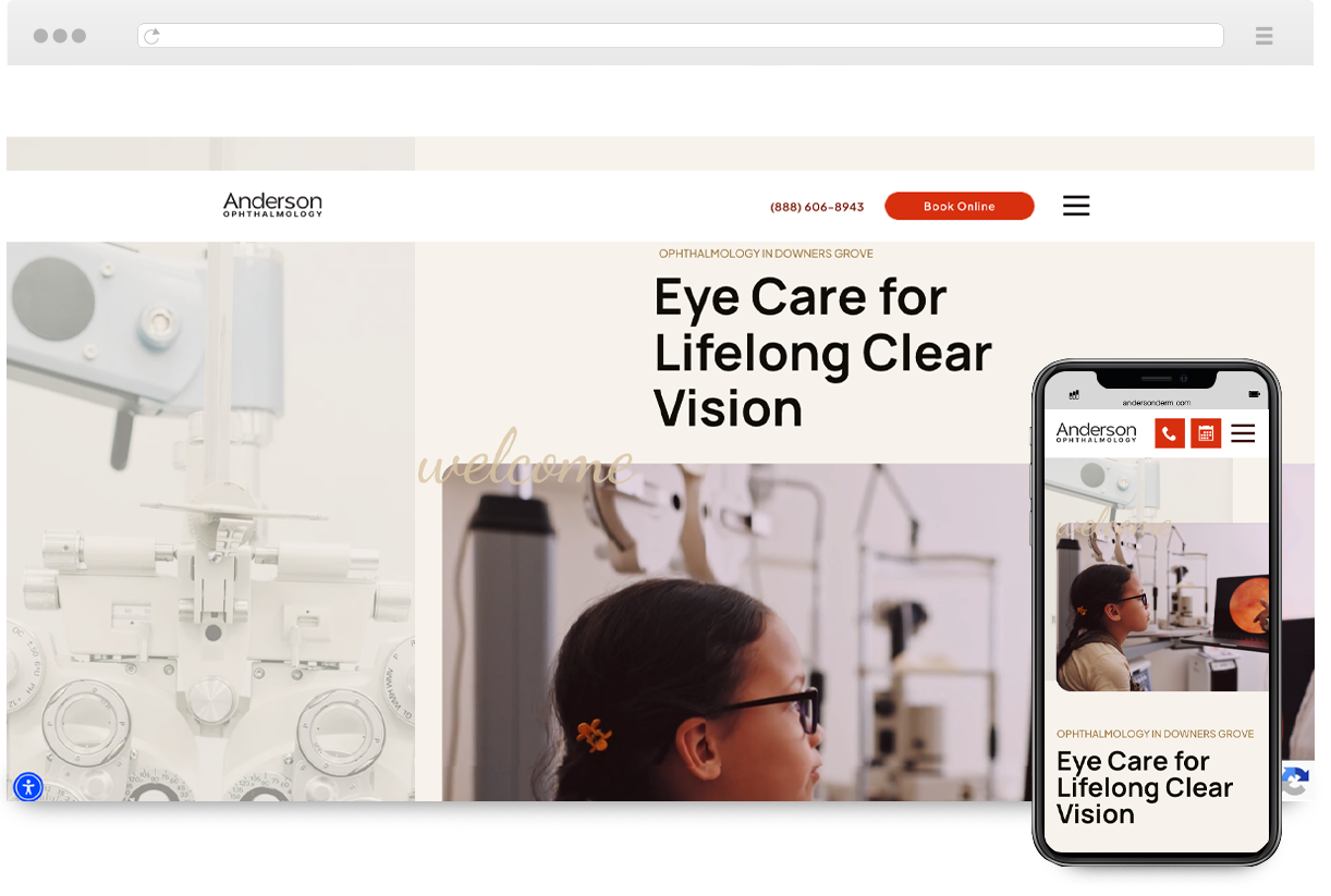 albany-ii-pro-vision